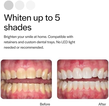 Opalescence 20% Teeth Whitening Refill Kit (2 Packs / 4 Syringes) Carbamide Peroxide. Made by Ultradent, in Mint Flavor. Tooth Whitening Refill Syringes. Includes a Toothbrush. - 5196-2TB
