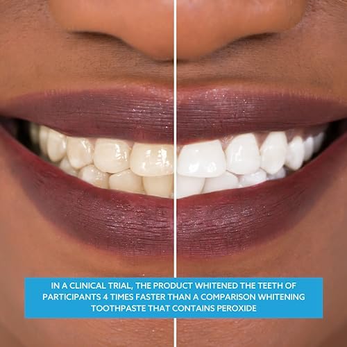 GO SMILE Teeth Whitening Gel, 3.4 OZ.