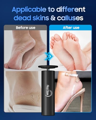 FSA&HSA Eligible Electric Foot File - Electric Callus Remover for Feet,Adjustable Speed Foot Scrubber with 60 Pcs Sandpaper Discs,Professional Pedicure Tool for Dead Skin and Calluses - Black