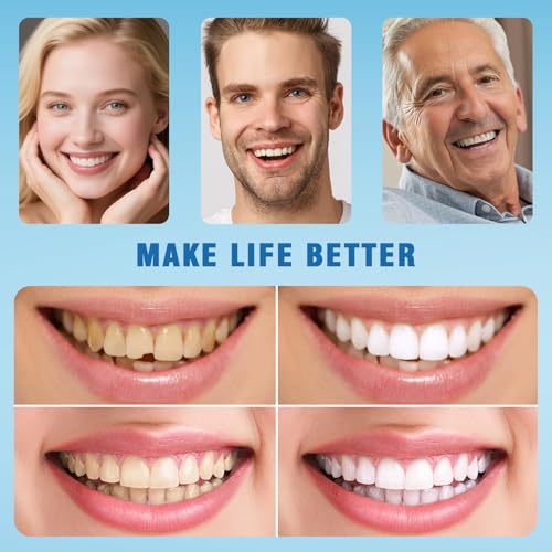 Moldable False Teeth - Silicone Dentures - Men and Veneers Teeth for Women - Upper and Lower Matching Set - Fix Your Smile at Within Minutes - 1PCS