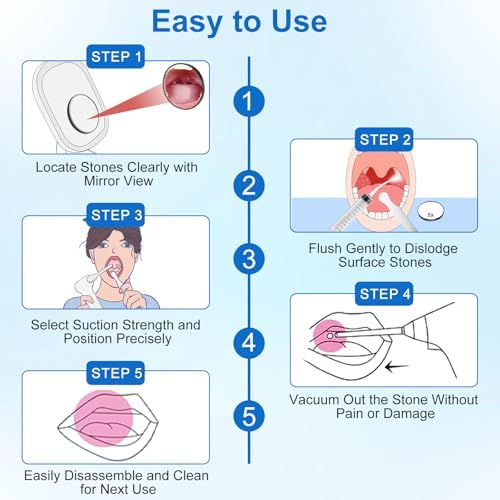 Tonsil Stone Remover Tool, Upgraded Electric Tonsil Stone Removal Kit - with Built-in LED Light & 6-Level Suction for Bad Breath Prevention, Oral Suction Device for Stone Removal