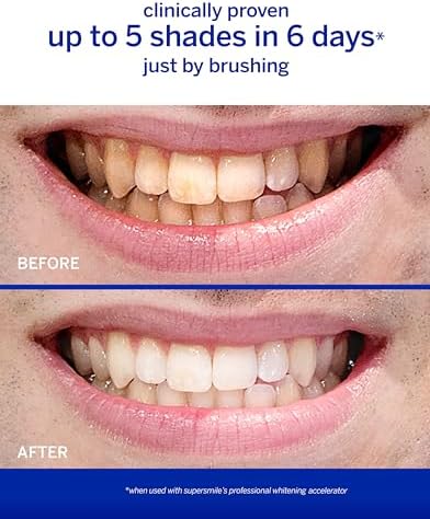 Supersmile Professional Toothpaste (4.2 oz, Cinnamon)