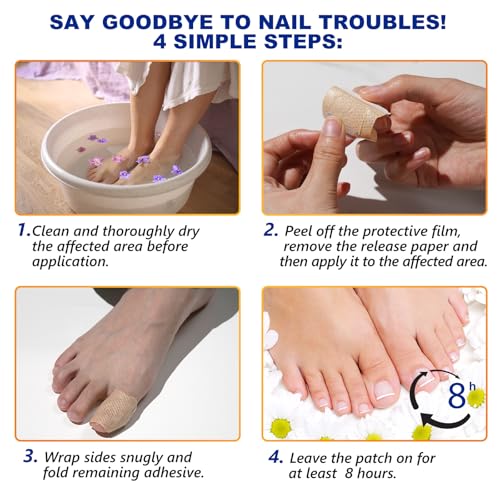 Toenail Treatment Extra Strength, 32 Patch Nail Patches for Nail Treatment Overnight, Nail Repair for Damaged Nails, Nails Care Supplies, Restore Discoloration (32 Patch)