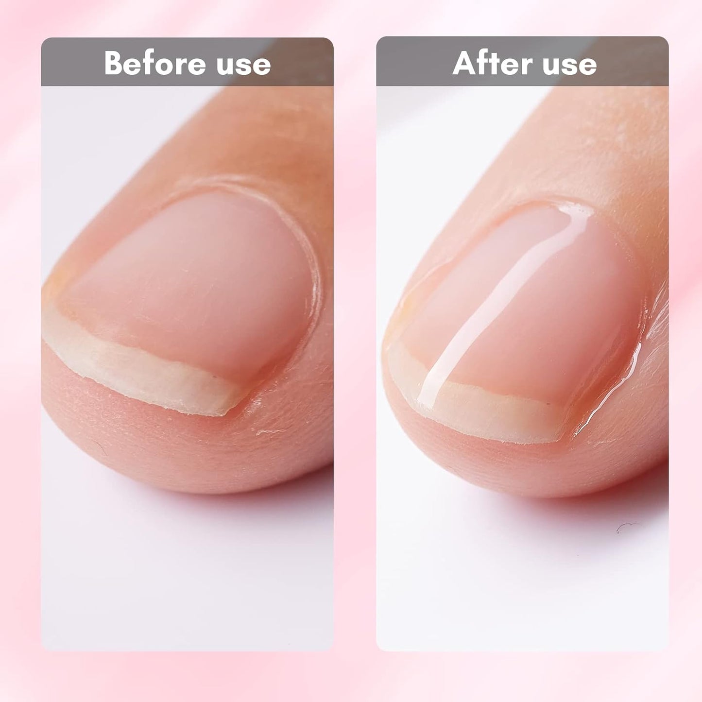Makartt Gel Nail Strengthener Reinforce Polish, Nail Strengthening Repair Polish Nail Hardener for Treating Weak Damaged Peeling Nails Clear Soak Off Gel Lacquer Long Lasting Professional DIY Nail Art