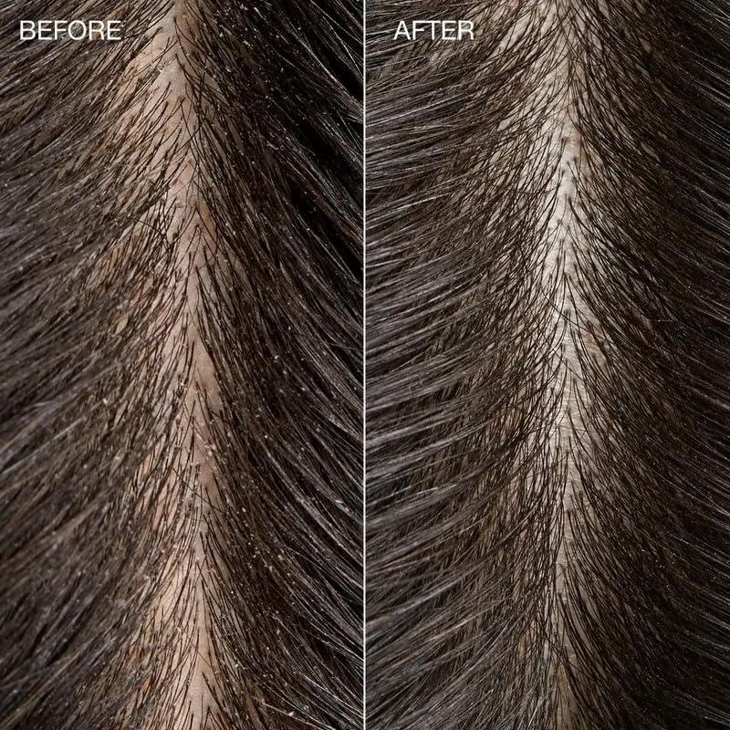 Tea Tree Special Detox Kombucha Rinse, Removes Buildup, Adds Shine, For All Hair Types